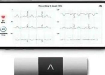 US-firm AliveCor taps India telemedicine market with ECG device