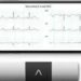 US-firm AliveCor taps India telemedicine market with ECG device
